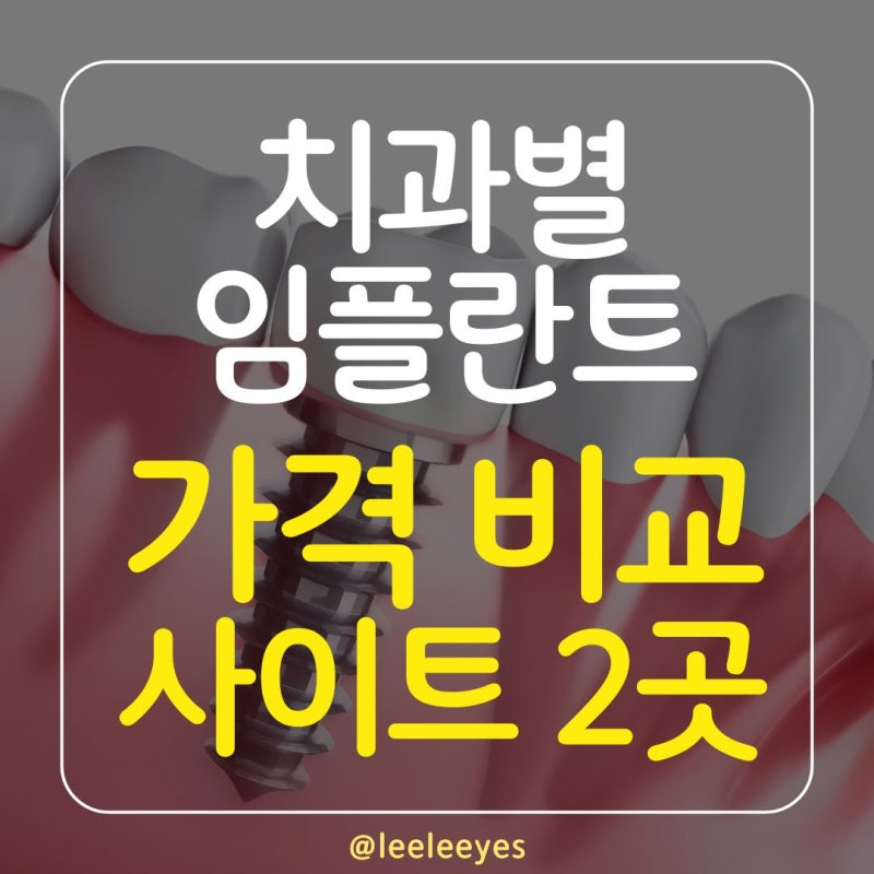 어금니 임플란트 가격 : 지역별 치과 가격 비교 사이트 2곳
