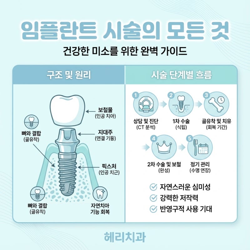임플란트 시술과정과 기간(통증 줄이고, 유지기간 늘리려면?)