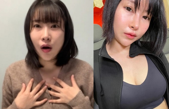 A컵에서 E컵까지? 개그맨 이세영 성형 후 자신감 뿜뿜