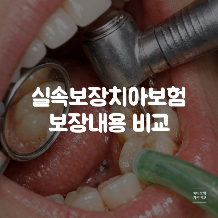  실속보장치아보험 보장내용과 비교하면서 알차게 준비해봐요
