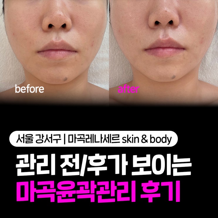  마곡윤곽관리 직접 받아본 후기, 얼굴 턱선부터 피부 상담까지 해주는 수기관리 전문샵 레나세르 스킨앤바디