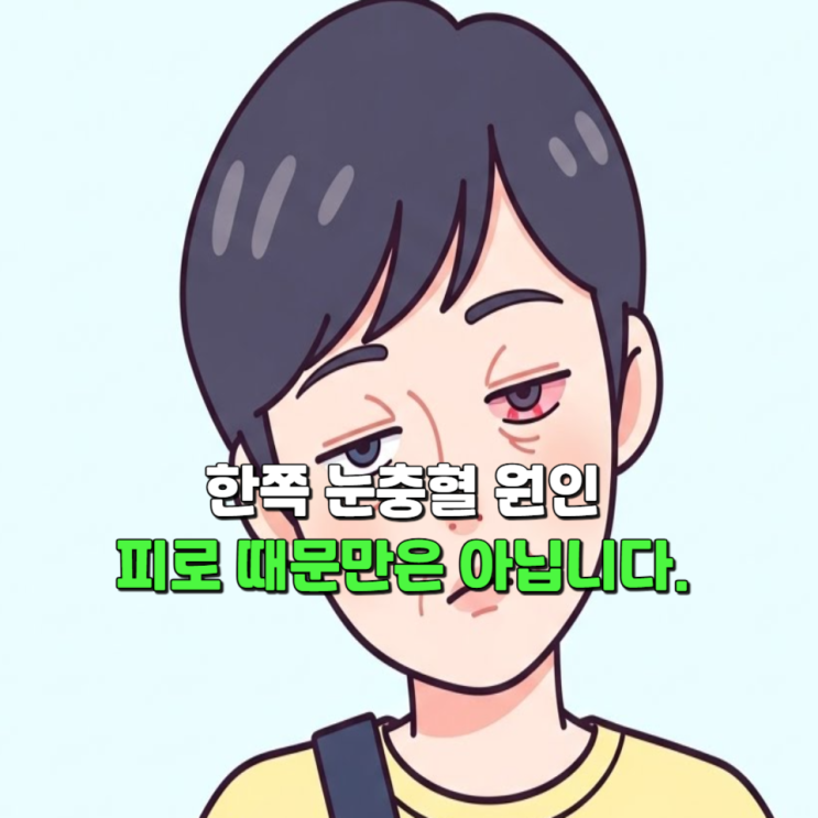  한쪽 눈충혈 원인 피로 때문만은 아닙니다.
