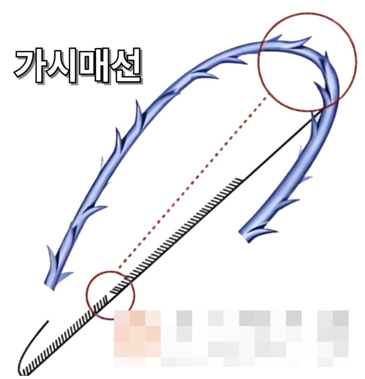  포항 피부과 추천, 피부 한의원에서 왜 피부를 볼까?