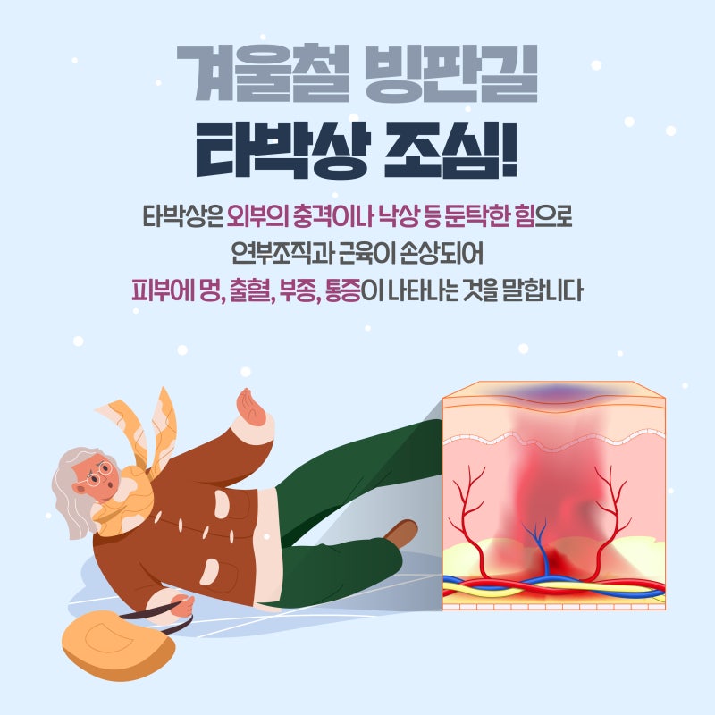겨울철 빙판길 낙상 주의 안내 이미지