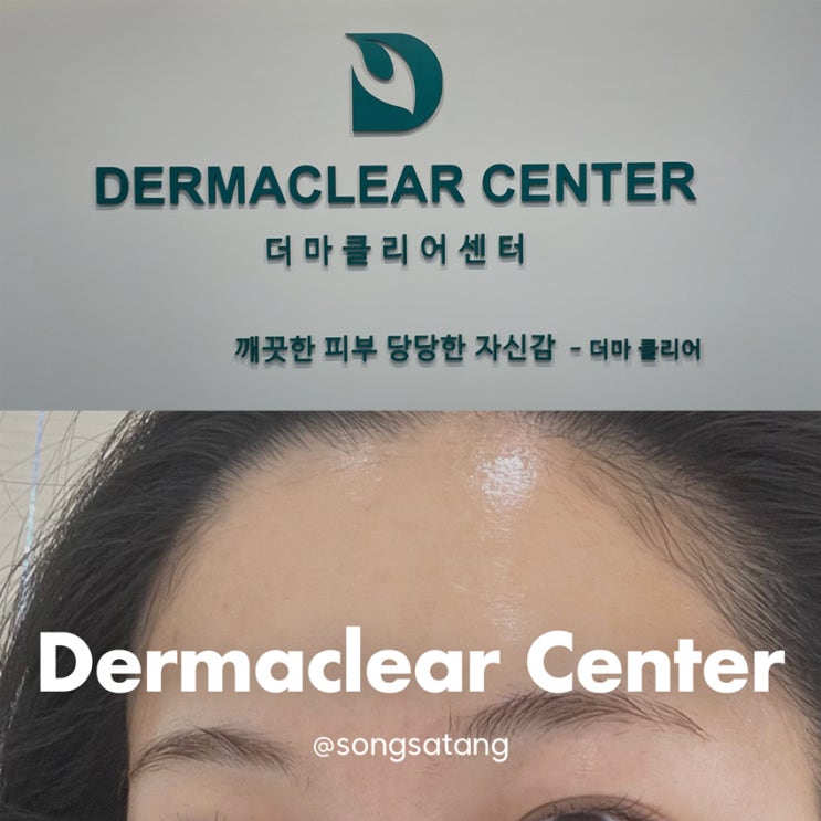  과천여드름 더마클리어센터 피부 시급할 때 재재방문