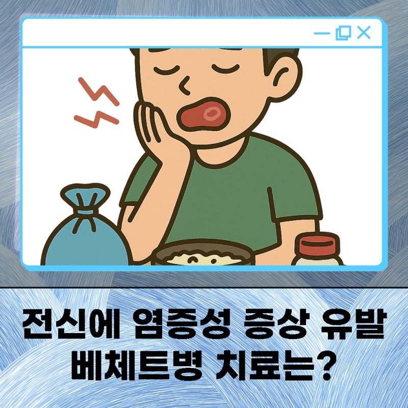 베체트병 전염성 질환이라는 오해와 진실