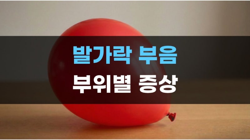 엄지 검지 두번째 네번째 새끼 발가락 마디 끝 빨갛게 부음 열감 증상 확인하기