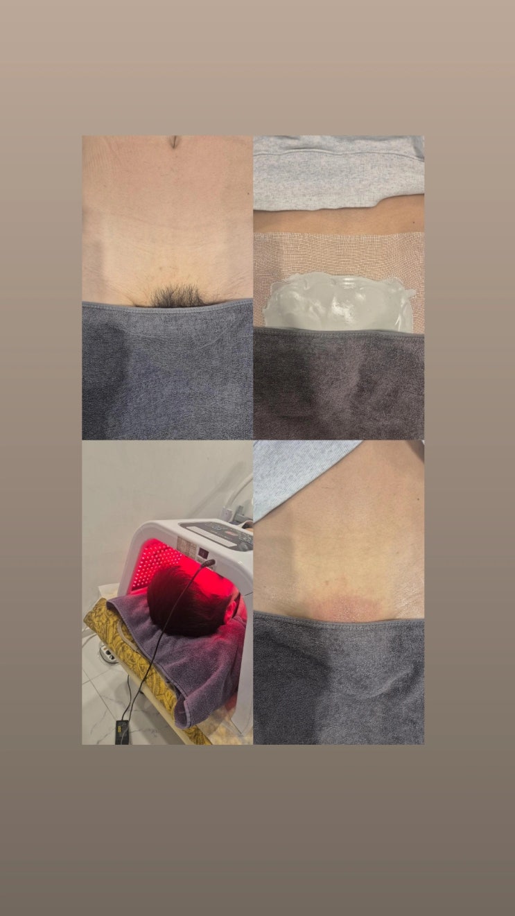  남자 브라질리언 왁싱 안아프게 하는 곳은 영등포 남자 왁싱샵 "청춘케어"