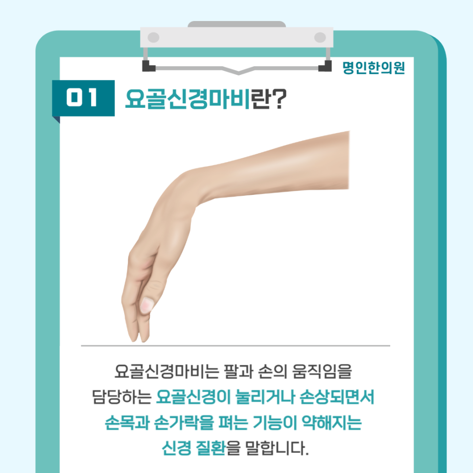 요골 사진 2