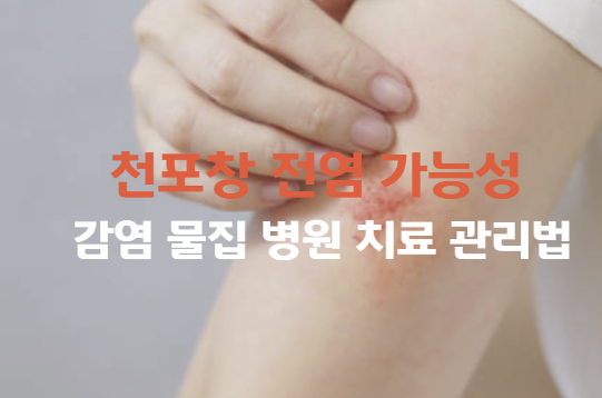 천포창 전염 가능성 감염 물집 병원 치료 관리법