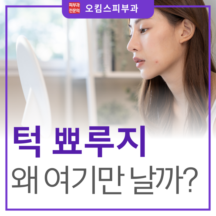 일산동구 여드름 피부과 턱주변 뾰루지, 왜 하필 여기에만 날까?