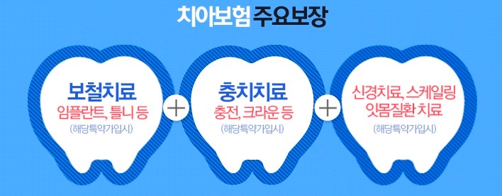  충치치료 치아보험 가입 시 보장내용 핵심 정리