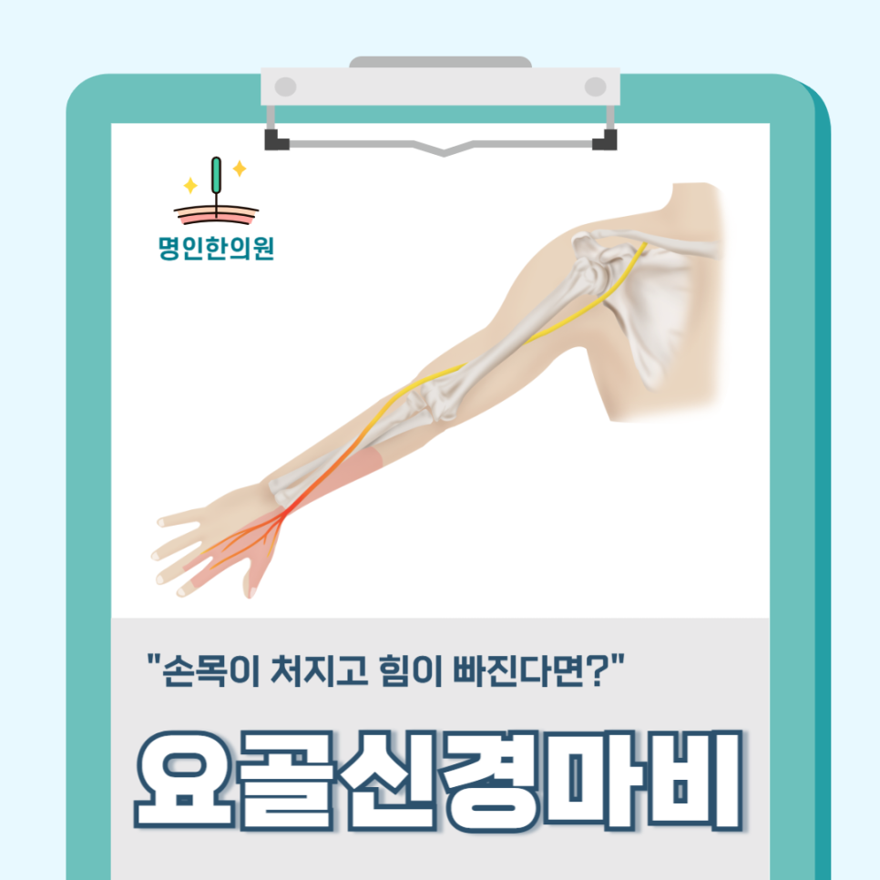 요골 사진 1