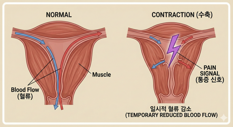 진통제 없이 생리통 탈출하기:자궁이 보내는 '구조 신호'를 듣는 법