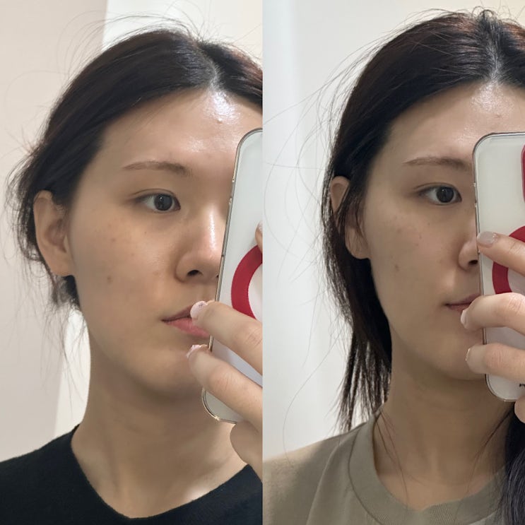  땅콩형얼굴 안면비대칭 고민 부천 상동 결이고은 마사지 후기 /부천 피부관리 부천 에스테틱 부천 작은얼굴 부천 경락