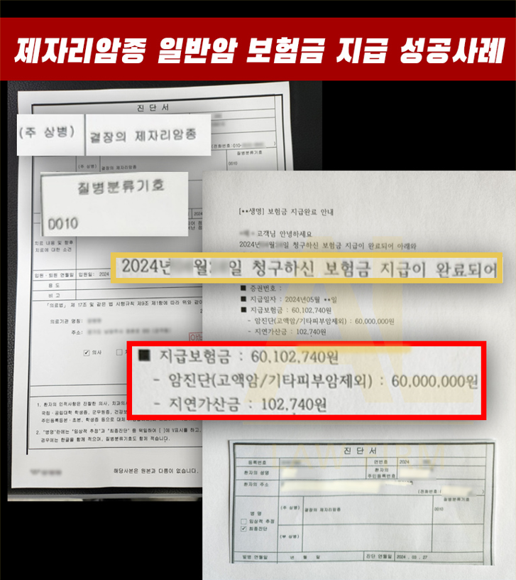  보험사는 '유사암'이라며 10%만 주겠다지만, 법리는 '일반암' 전액 지급을 말합니다