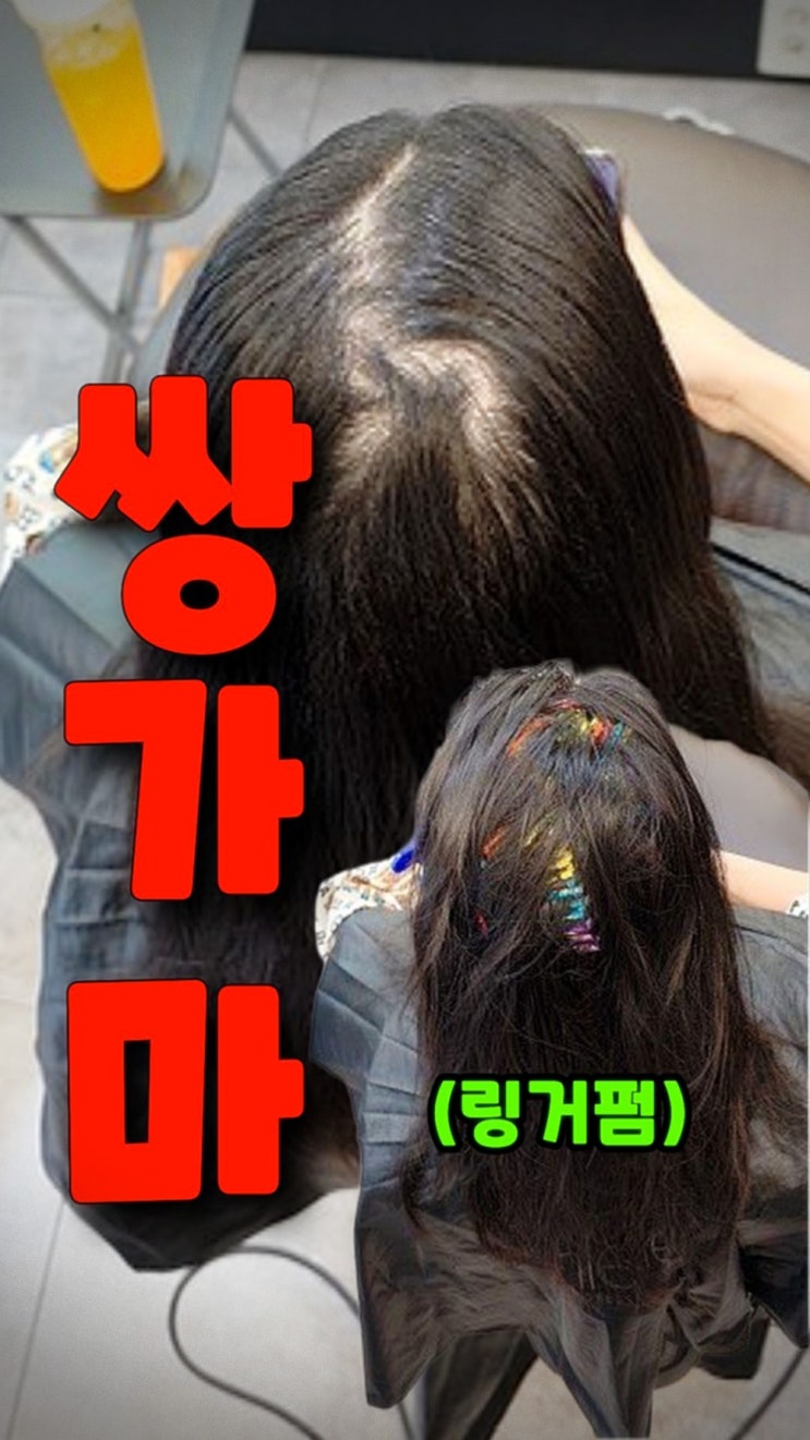  링거펌으로 쌍가르마 해결! 정수리 볼륨 완벽 복구 후기