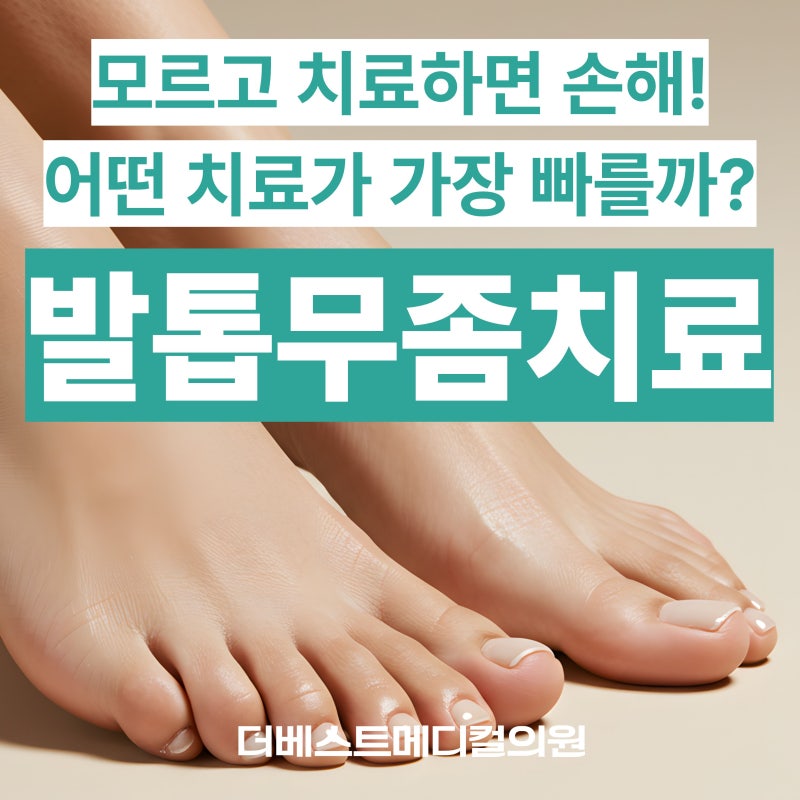 인천 계양 발톱무좀 | 발톱 무좀 치료법 총정리! 어떤 치료가 가장 확실할까?