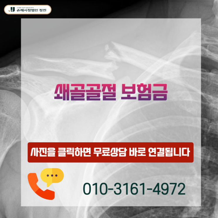 쇄골골절 보험금, 수술했는데도 팔이 안 올라간다면? 후유장해 2,00 0만 원 놓치는 결정적 이유