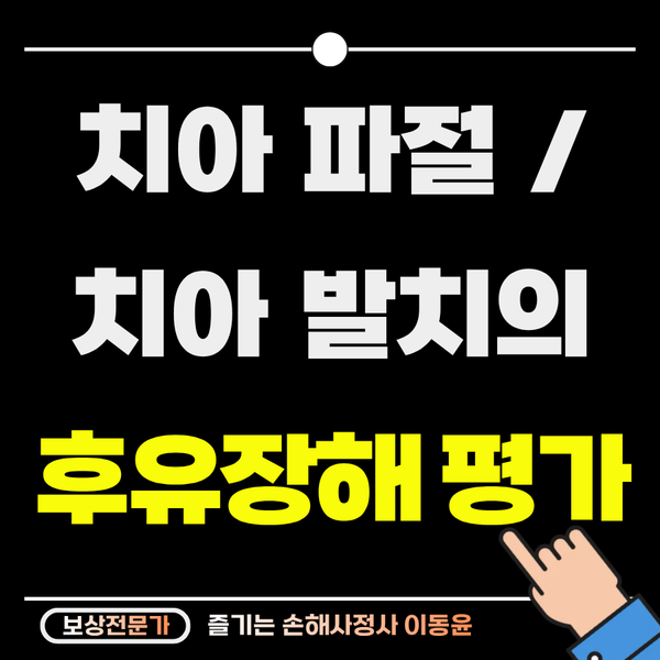  치아 파절 혹은 발치에 대한 후유장해 보상 기준