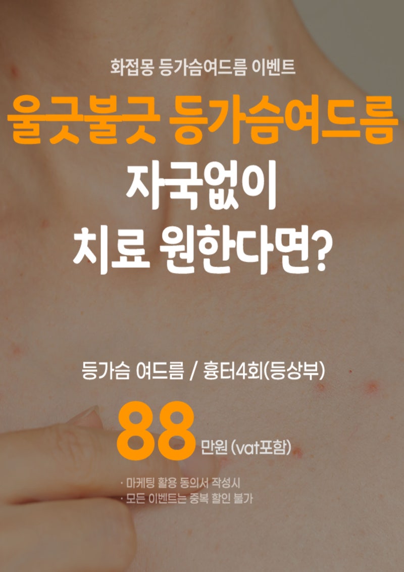 2026년 4월 등드름& 가슴여드름& 모공각화증 이벤트/ 편평사마귀, 검버섯, 쥐젖, 거우침 이벤트