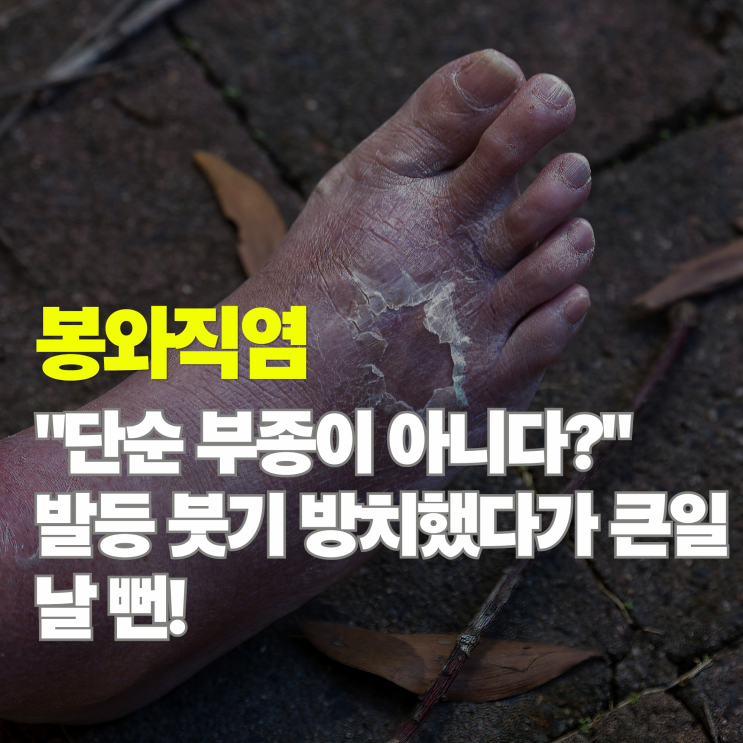  봉와직염 증상 5가지, 단순 부종인 줄 알았는데 전신 패혈증까지?