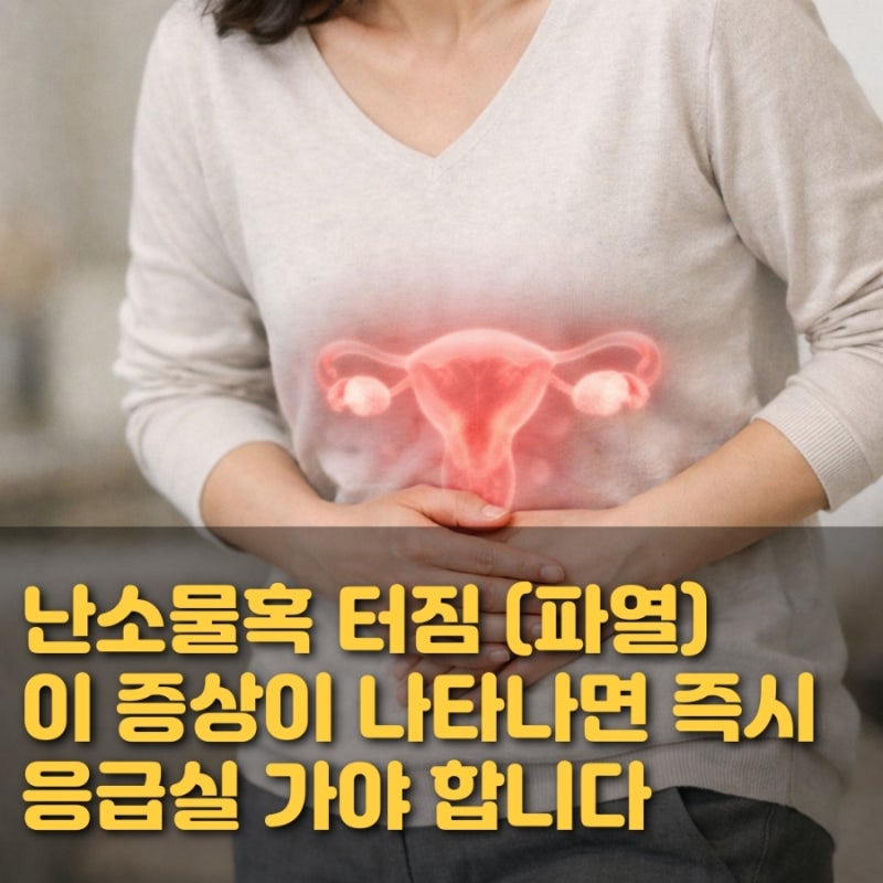 난소물혹 터짐(파열), 이 증상이 나타나면 즉시 응급실 가야 합니다