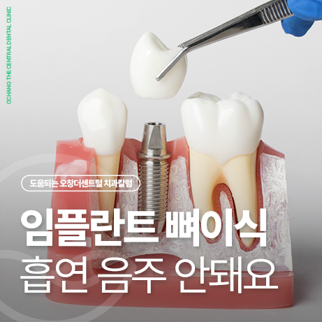 임플란트 뼈이식 후 통증 흡연 음주 안돼요