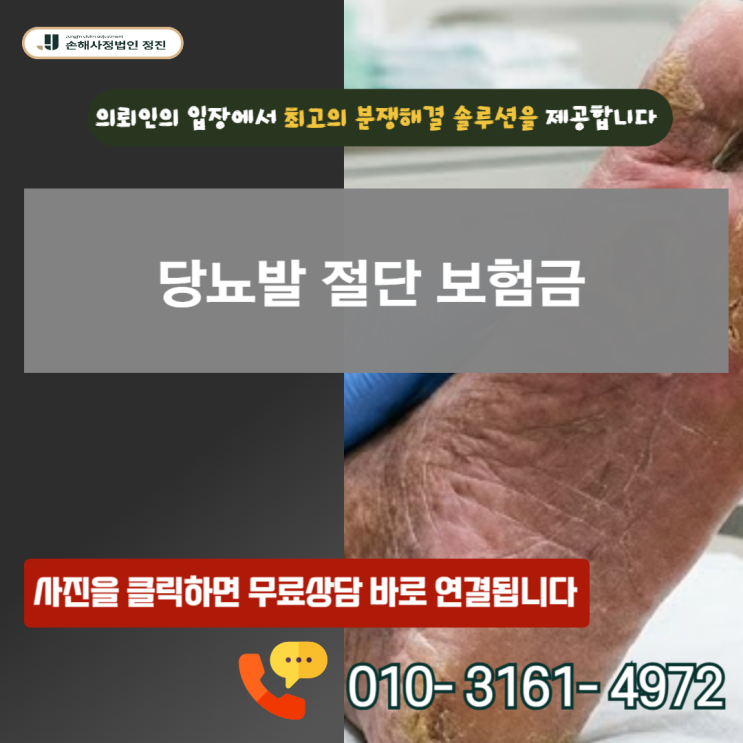  당뇨발 절단 보험금, 지급 거절 뒤집는 결정적 기준 (손해사정사가밝힌 실전 전략)
