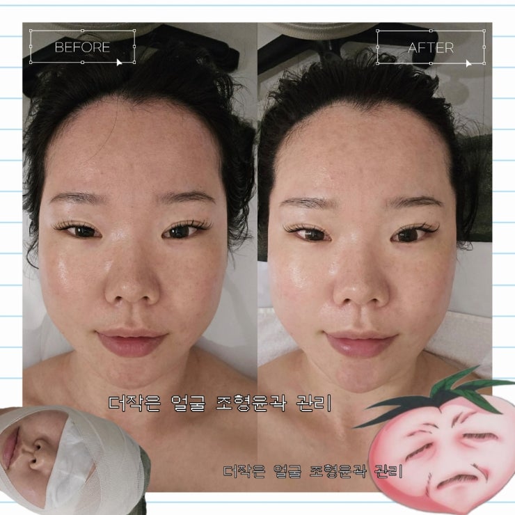 청량리 피부관리 더작 청량리점 작은얼굴관리 후기
