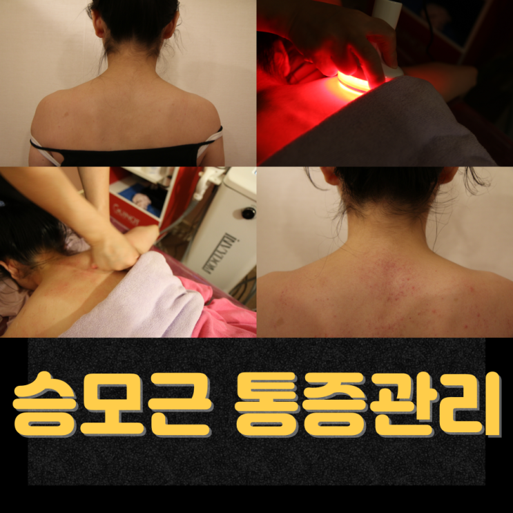  천안 신부동피부관리 승모근관리 등관리 어깨통증관리, 결과가 달라지는 이유