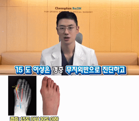 엄지발가락 테이핑? 무지외반증 환자들에게 드리는 조언