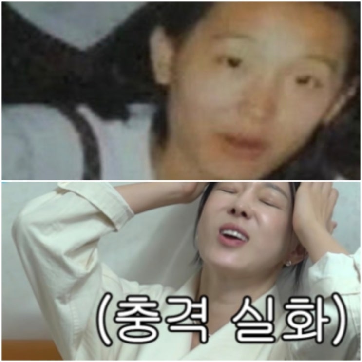  "성형 전 관상이 더 좋다고?" 뒷목 잡은 이지혜, 고치기 전 얼굴 어땠길래