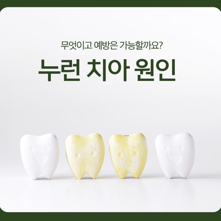  누런 치아 원인, 무엇이고 예방은 가능할까요?