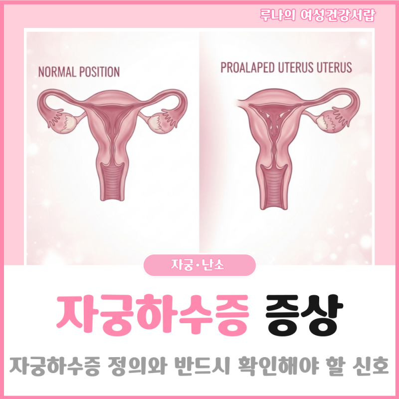 자궁하수증 모르게 진행되고 있는 증상 반드시 확인해보세요