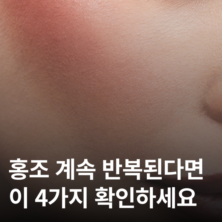  홍조, 그냥 두면 더 심해집니다 (4가지 특징 원인 총정리)
