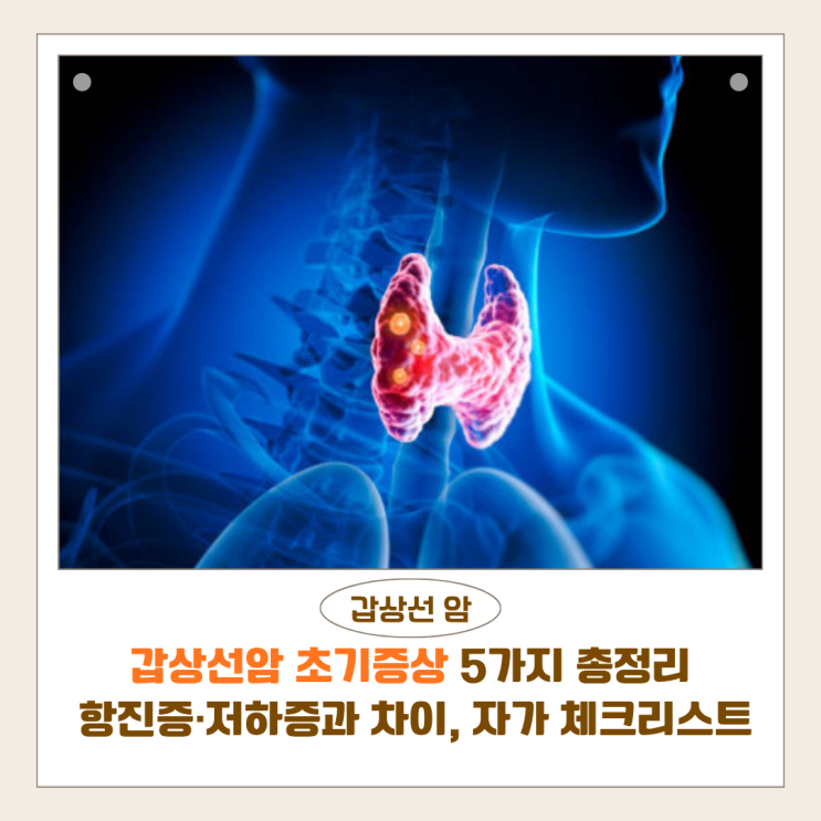 갑상선암 초기증상 5가지 총정리 | 항진증·저하증과 차이, 자가진단 체크리스트