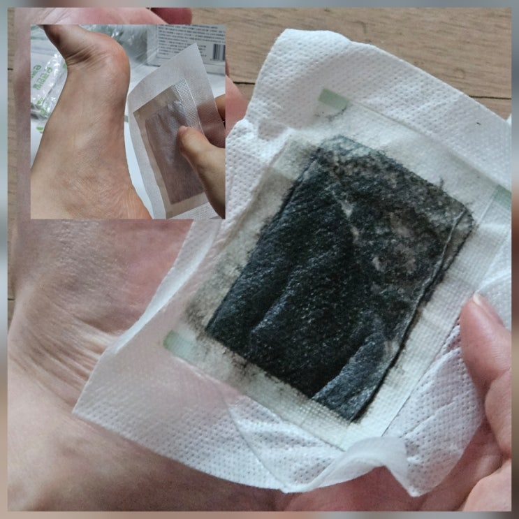  발바닥패치 독소패치 가성비좋은 e편한발 쑥 대나무 목초수액 시트 후기