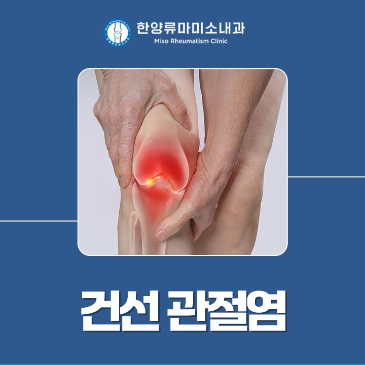 목동내과 봄철 관절 통증, 건선 관절염 가능성도 살펴보세요