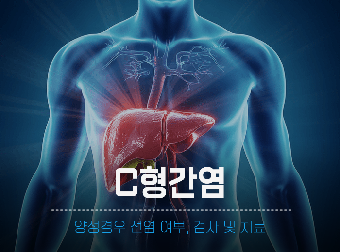 C형간염 양성 경우 전염 여부, 검사 접종 및 치료