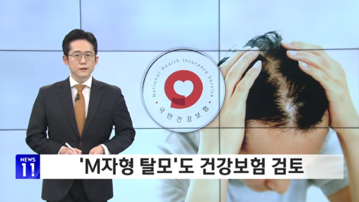  'M자형 탈모'도 건강보험 검토…혜택 얼마나? [SBS Biz]