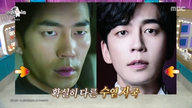 신성록, 수염 제모 후 얼굴 변화… ‘카톡개’ 시절과 확 달라진 인상 공개