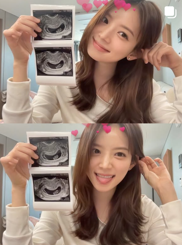 동상이몽 트레바리 윤수영 김지영 남편 대표 매출과 강남 집 아지트 위치