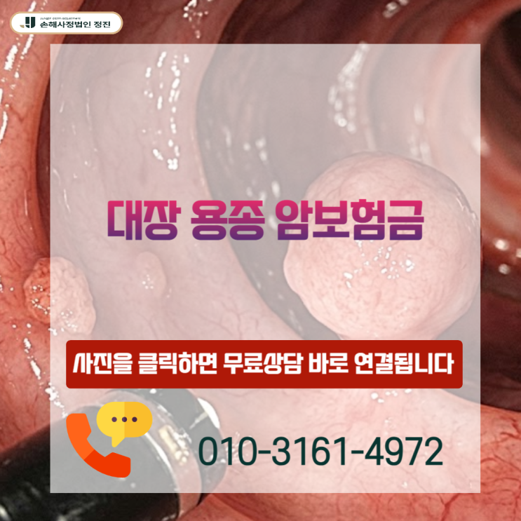  대장 용종 암보험금, D12.6인데 수천만 원 받는 이유 (실무 기준 공개)