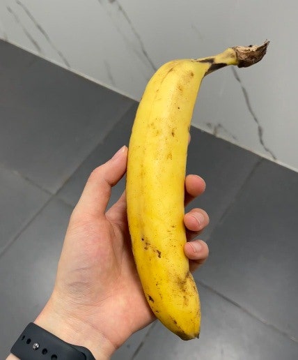 만성치열 수술 받기 전에 꼭 알아야 할 것들