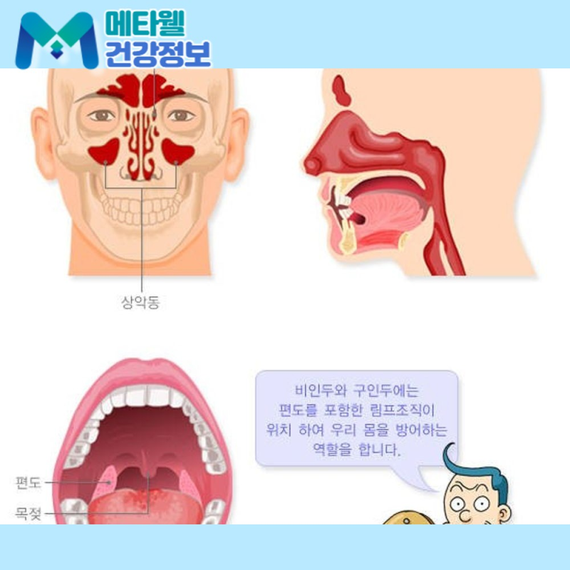 목 부었을때 대처법 - 타이레놀 찬물 아이스크림 효과와 주의사항