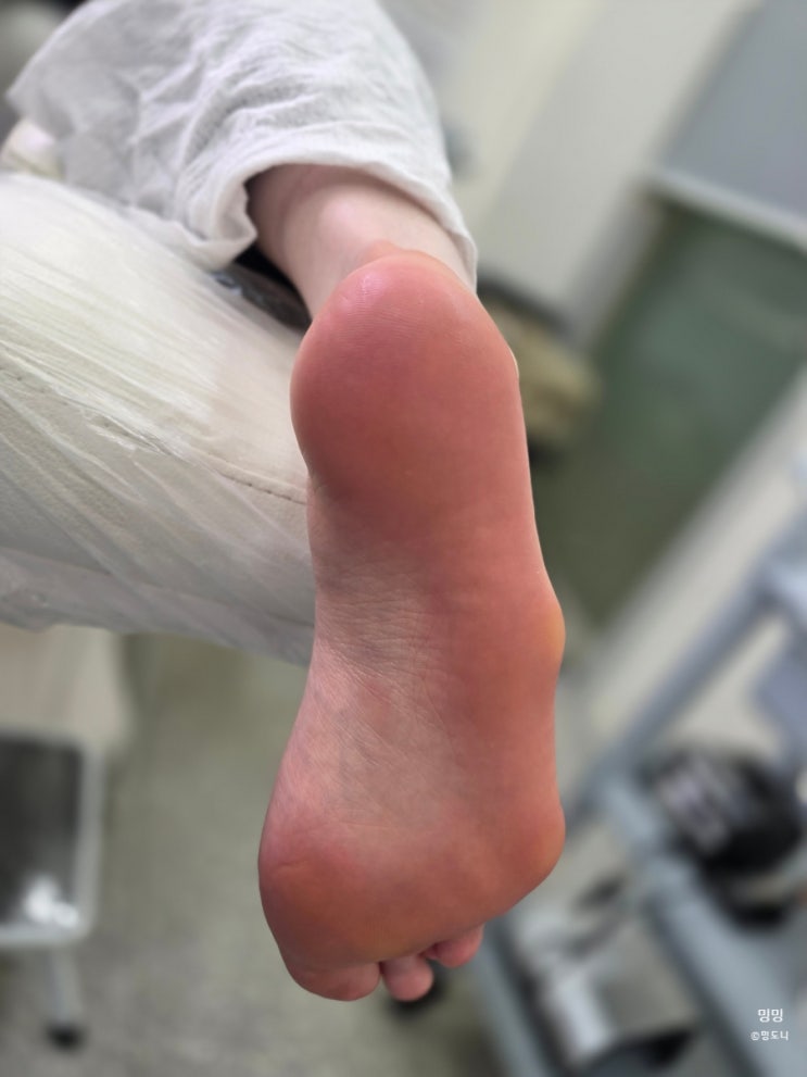  노원 발각질제거 잘하는곳 찾다가 정착한 네일러그 레푸스 노원역점