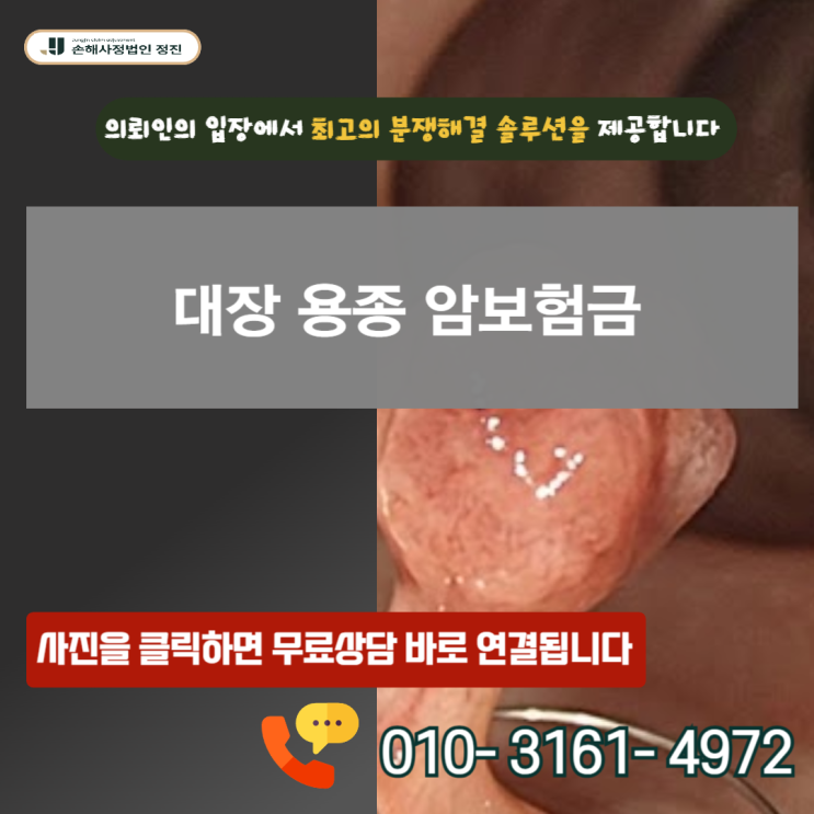  대장 용종 암보험금, D12 코드임에도 수천만 원의 보상을 받을 수있었던 결정적 이유