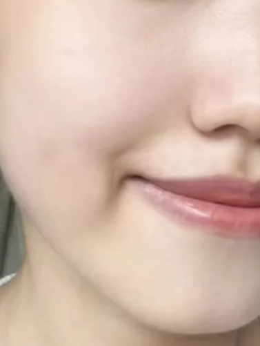  붉은기 민감 트러블 잡는 펩타이드 크림