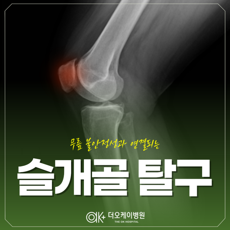  춘천 무릎 불안정성과 연결되는 슬개골 탈구, 반복되는 원인은